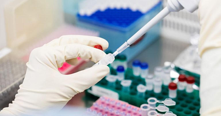 Biología Molecular en Operon