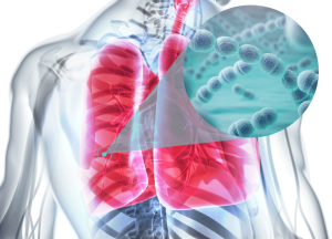 s-pneumoniae-serotype-3